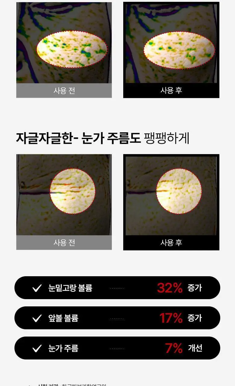 [아이백 개선/탄력볼륨] 메디테라피 링클핏 탱글 아이패치 4회분 상세페이지 15